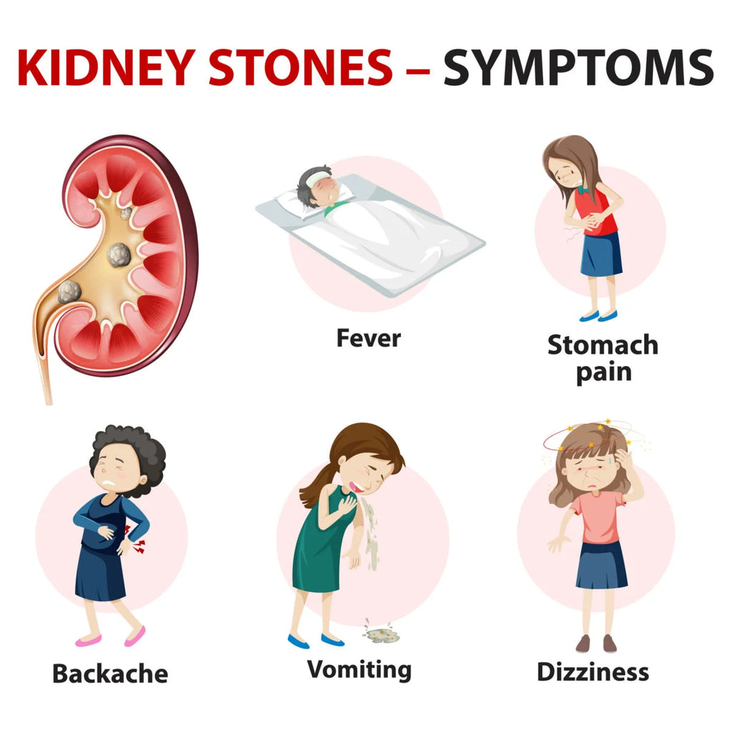 Stonil Capsule (20 Capsule)