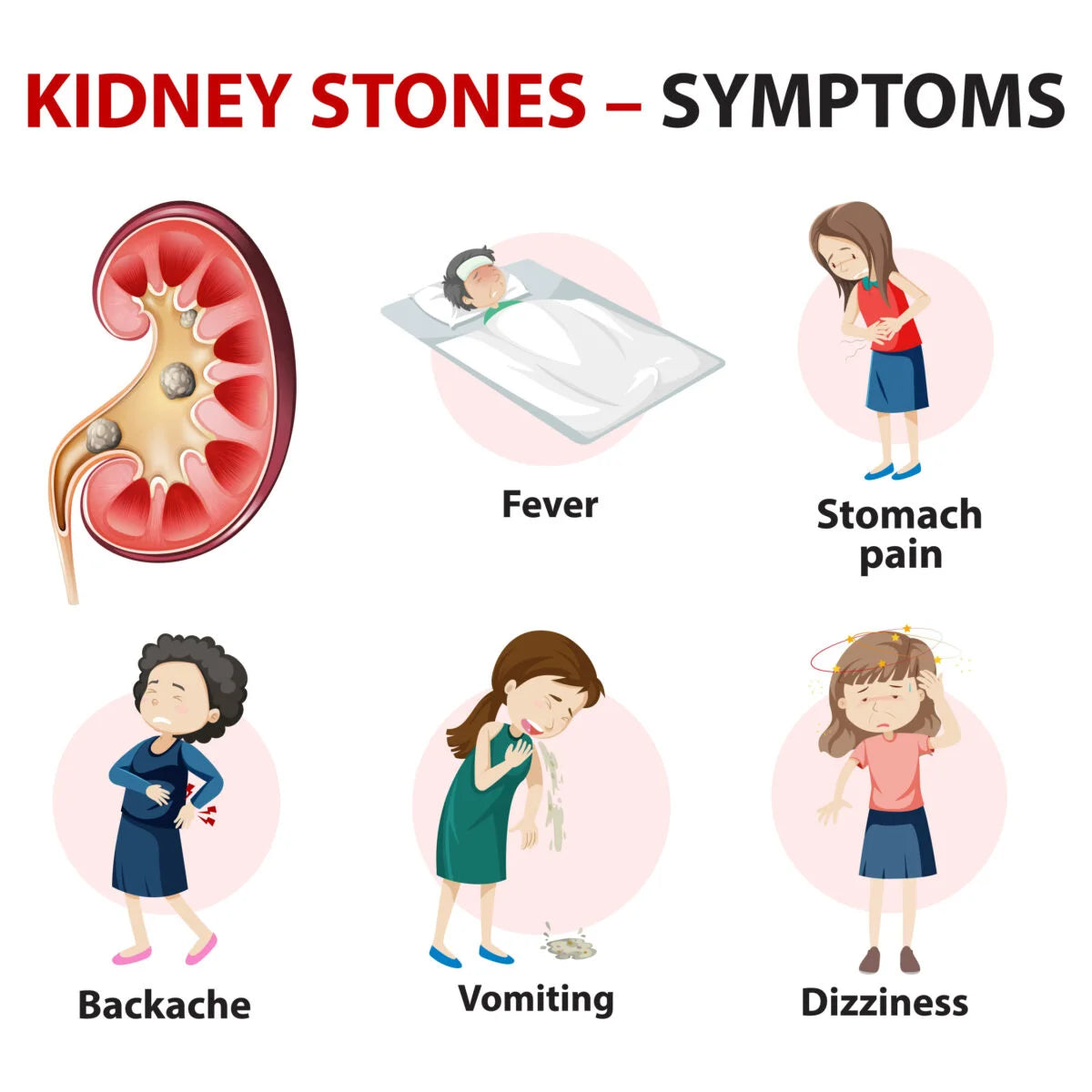 Stonil Capsule (20 Capsule)