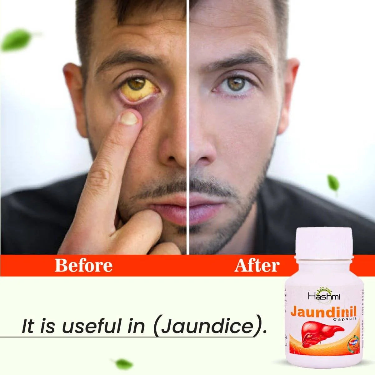 Hashmi Jaundinil Capsule (20 Capsule)